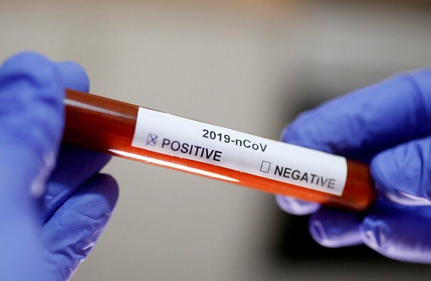 Сразу 8 новых случаев заболевания коронавирусом зарегистрировано в Белгородской области (обновлено)