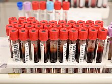 Советы врача: можно ли вылечить гепатит