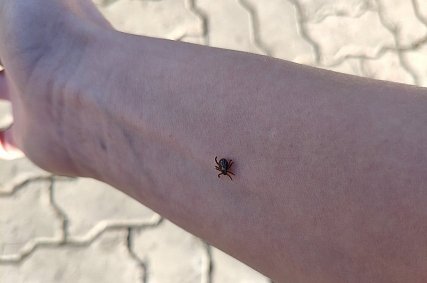 55 человек заболели боррелиозом после укуса клеща в Белгородской области