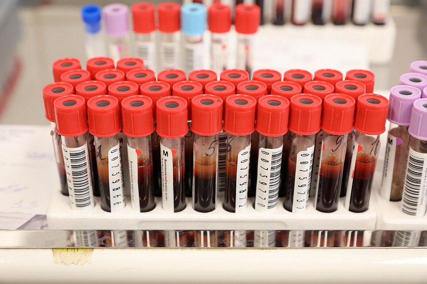 Советы врача: можно ли вылечить гепатит