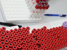 Советы врача: может ли диспансеризации помочь выявить онкологию