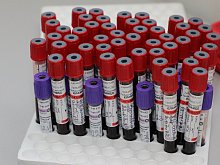 Советы врача: что такое чекап и зачем он нужен 