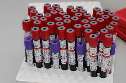 Советы врача: что такое чекап и зачем он нужен 